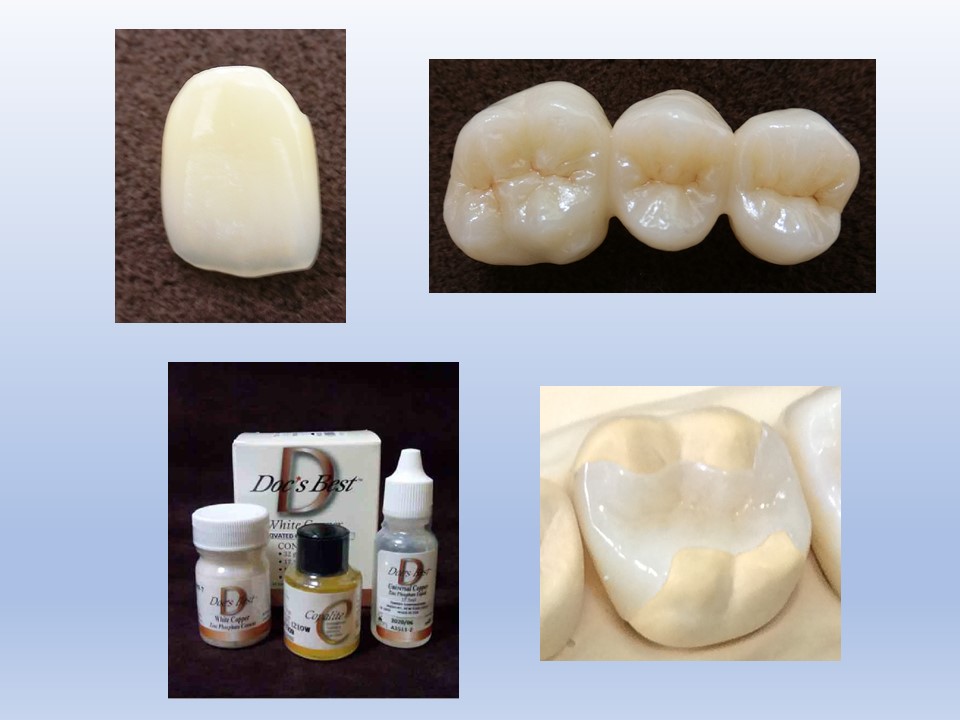 虫歯の治療のイメージ